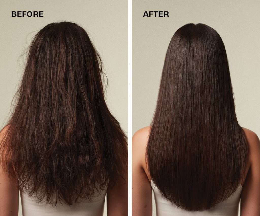 smoothplus gallery beforeafter 01 jan25